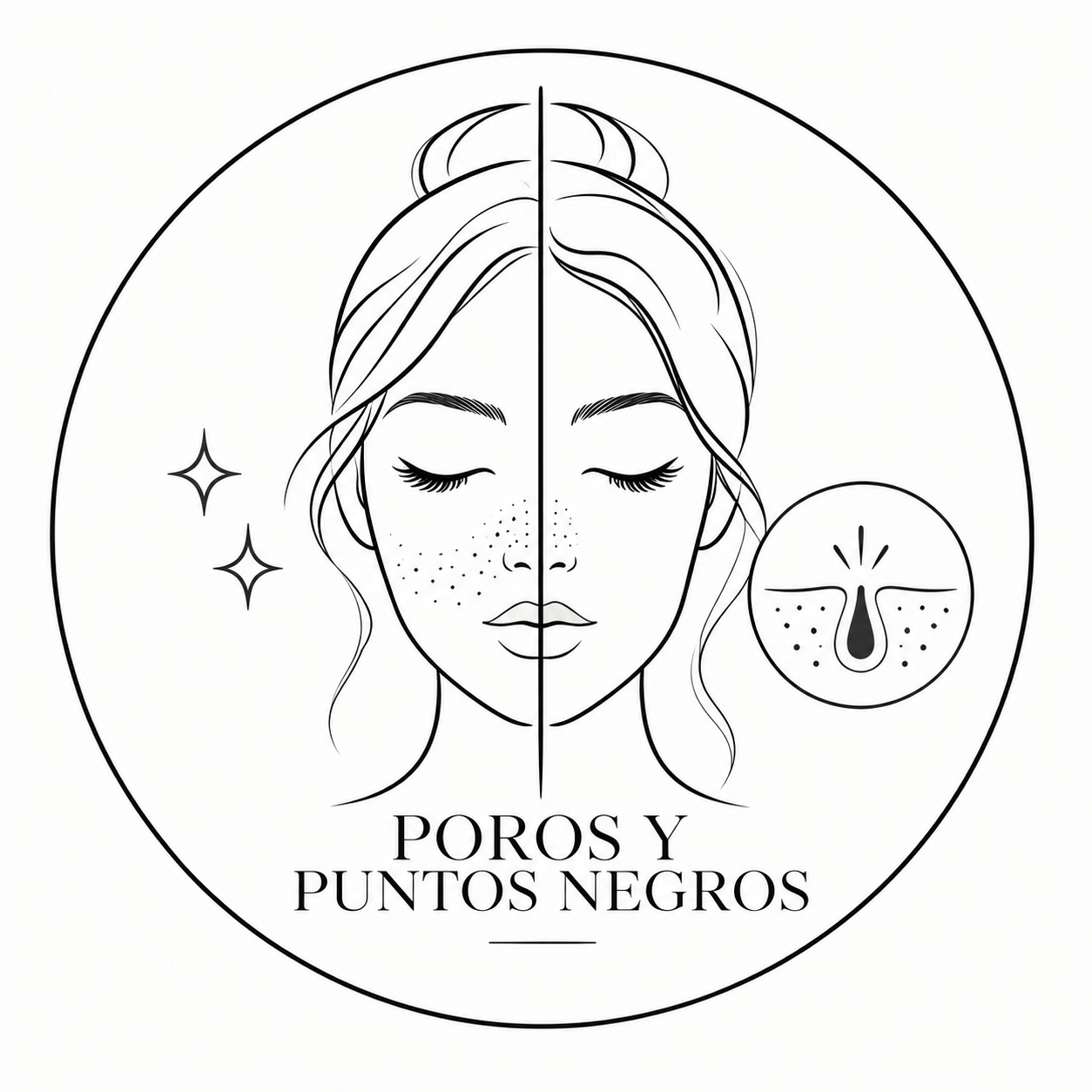 Poros y puntos negros